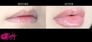 CandyLipz
